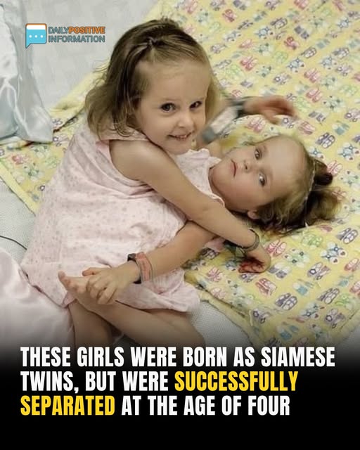 Now they are over 18, and you better sit down before seeing how they look like today 👀 Have a look at the photos of the girls in the comments below”👇👇👇