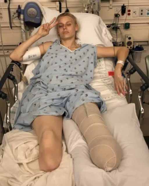Woman loses her legs due to common household product, now she\’s warning women everywhere – check comments 😭👇🏻