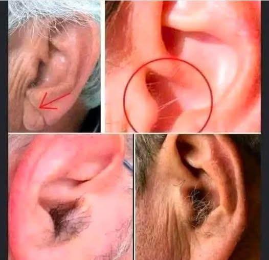 Did you know that if your ear hairs grow, it is because your body is… See more