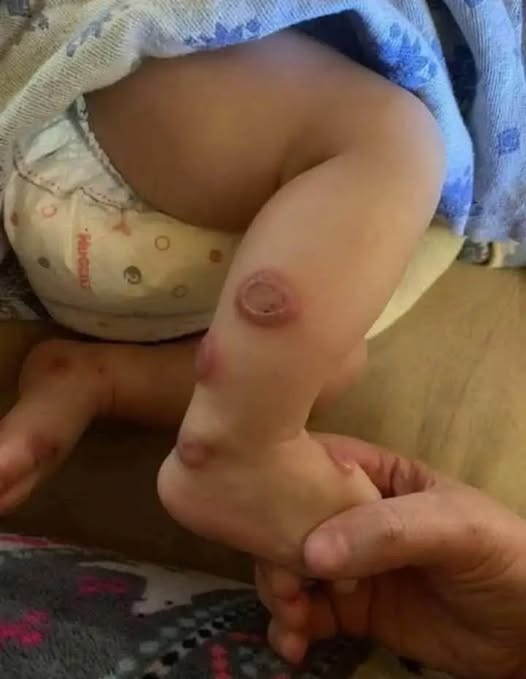 ️ALERT: These are the signs that it\\\’s cre…See more in comment