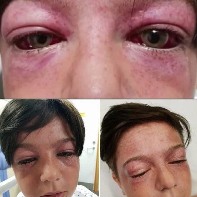 11-year-old found unconscious and ”looking like an alien”, then mom learns horrific truth and shares a warning for all parents…Check comments 👇🏻😢