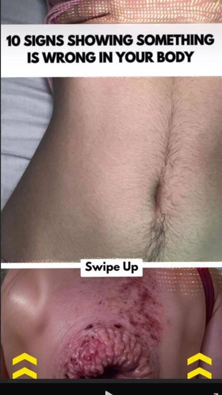 10 Signs Showing Something Is Wrong in Your Body