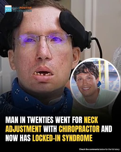 Georgia man suffers locked-in syndrome after simple neck crack — and it happened in seconds 😱 Doctors call it one of the rarest and most horrifying stroke complications ever recorded. Full story in comments 👇