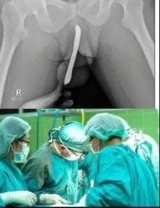 😱😢Girl had to be hospitalized for wanting to use a pe…See moree