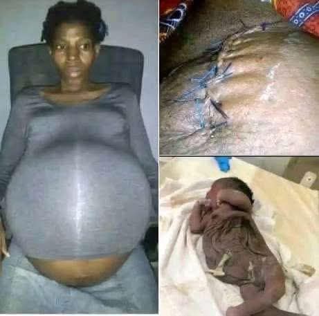 A 30-year-old woman in Georgia was declared brain dead……see More