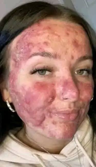 Her body was itchy, she thought it was an allergy, they diagnosed her with ca…see more