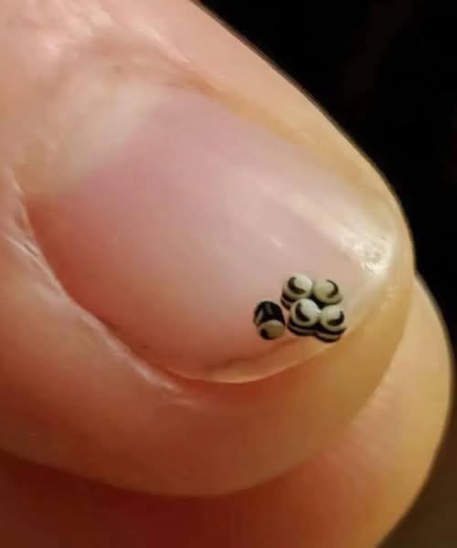 My friend and I were having dinner at a trendy restaurant when she suddenly noticed tiny black specks on the salad 😲. At first, we thought they were chia seeds, but those little balls started to move 😱. I called the waiter over in sh0ck 😲. As soon as we realized what it was, we rushed to the hospital 😱. I\’m sharing this with you – please be careful 😣😥. The rest of the story is in the article below the photo ⬇️