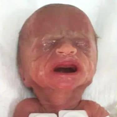 Baby born 14-weeks premature, weighing just 1 pound – but try not to smile when you see this young lady today 😍 Check comments 👇🏻