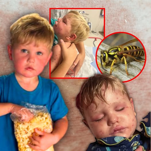 A 2-year-old boy is fighting for his life in Georgia after being stung over 150 times by yellowjackets.— (Detail Check Below)