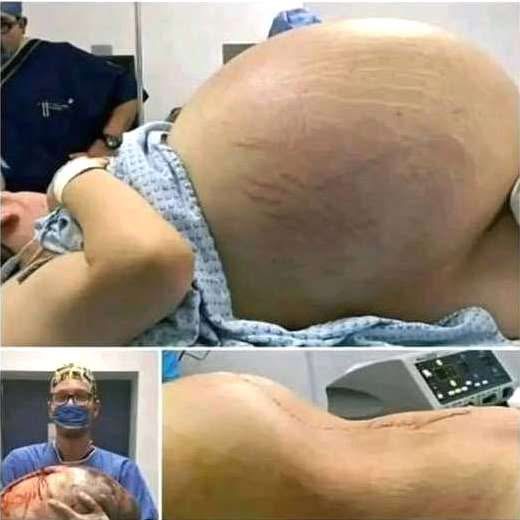 She went into labor, and you won’t believe what they took out of her wo…See More