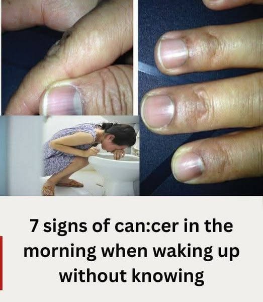 Waking up and seeing these 7 signs proves that your body is silently “feeding” cancer cells without you knowing it 👇👇👇