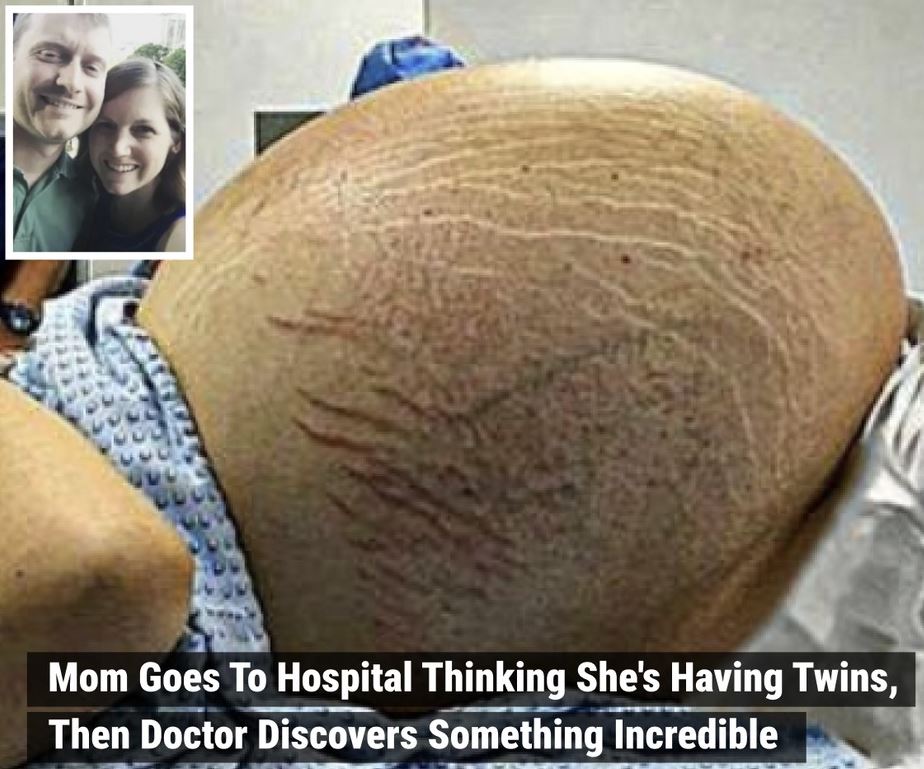 When they got to the hospital and the doctor looked at the ultrasound, he saw something that the mother couldn’t believe. How do you feel about this?