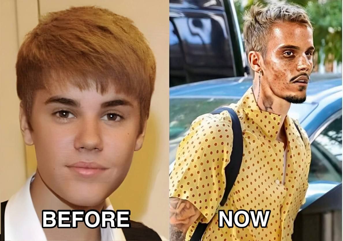 🥺Justin Bieber admits that he tested positive for…See more