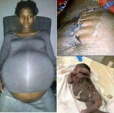 A 30-year-old woman in Georgia was declared brain dead……see More