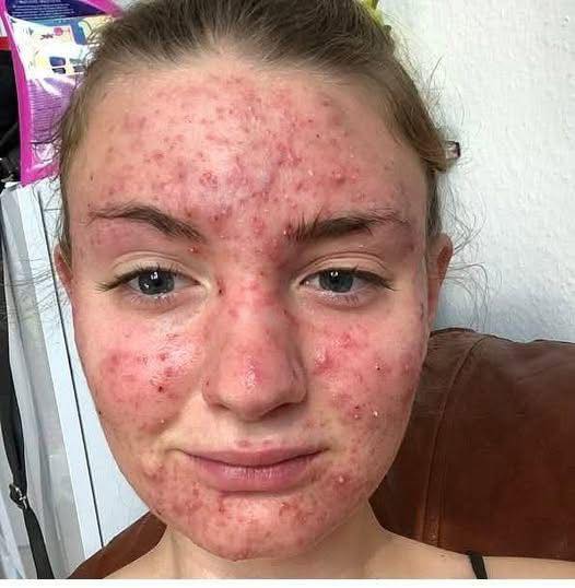 Her body was itching, I thought it was an allergy, they diagnosed ca… see more