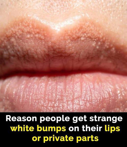 You might notice them in some unexpected areas..⬇️