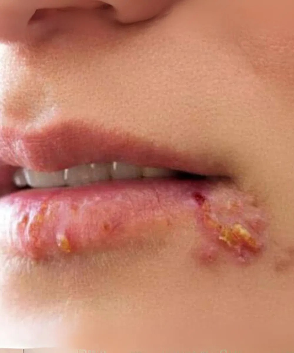 If you see this appearing on your lips, it is a sign of ca Read full story in comment…