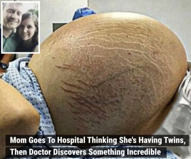 When they got to the hospital and the doctor looked at the ultrasound, he saw something that the mother couldn’t believe. How do you feel about this?