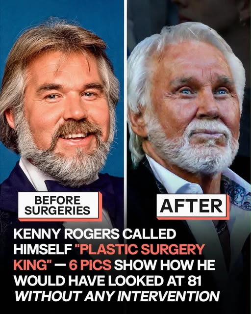 “The truth is I don’t know what I would have looked like if I hadn’t done it,” once said Kenny, who eventually regretted doing the surgeries.😥 PICS of Kenny Rogers with NO SURGERIES imagined by AI.⬇️