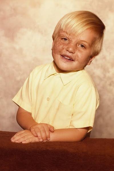 In 1978, 14-month-old Keith Edmonds wouldn’t stop crying in his crib. His mother’s boyfriend, enraged by the toddler’s cries, held Edmonds’ face to an electric heater, causing third-degree burns across 50 percent of his face. The abuser was sentenced to 10 years in prison. Keith spent a month in the hospital fighting for his life — and today, he wears his scars with pride. And you better sit down before you see what he looks like now in the comments below 😳👇🏻