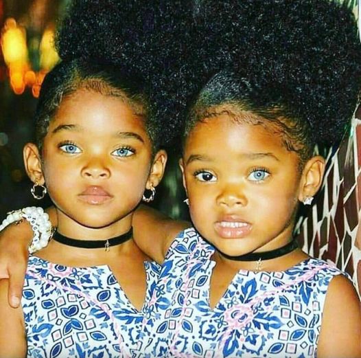 The ‘Blue Twins’ took the world by storm and made headlines worldwide – this is how they look today… See in comments 👇