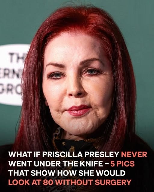 Once subjected to the hands of an unqualified surgeon, Priscilla Presley’s transformation is shocking. 😳 AI imagines her natural look today. (check in the first comment👇)