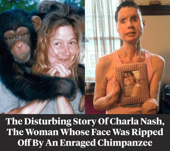 Go inside the shocking story of Charla Nash’s survival 😮👇🏼