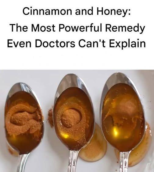 Cinnamon and Honey: The Most Powerful Remedy Even Doctors The article in the first comment