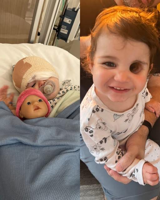 HER MOM KNEW SOMETHING WAS WRONG 😢👁️ Doctors said it was nothing… but what they found in baby Nuala’s eye changed everything. A story of courage that will leave you speechless! 💔👇
