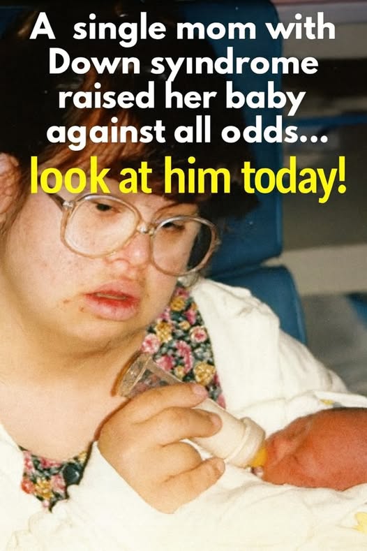 A single mother with Down syndrome beat the odds to raise her baby… look at him now! 👩‍👦✨ (Check In First comment👇)