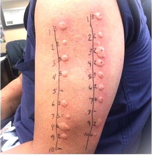 These are the consequences of sleeping with the… See more