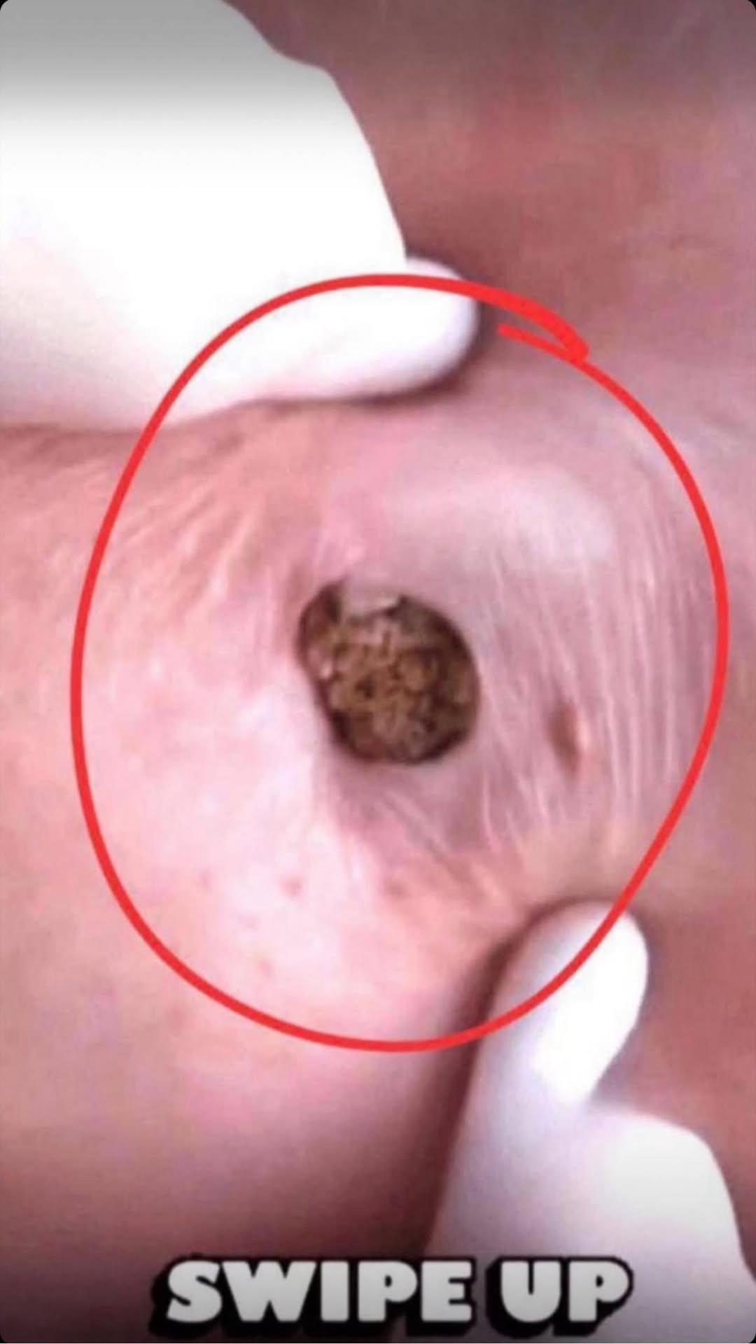 How to Treat Pimples: Gentle, Proven Solutions for Clearer Skin at Any Age