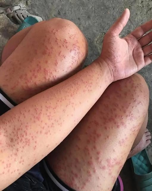 I spent a few nights at my friend’s old place and saw these weird bumps… (Check In First comment👇)