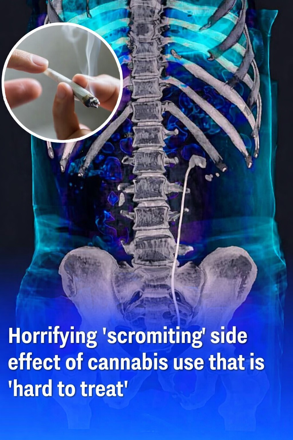 This Makes the Munchies Look Harmless 😳 FULL article in comments!