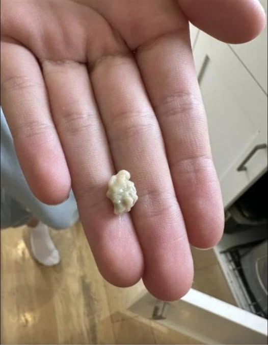 I sneezed 4-5 times yesterday and then felt something tickling my throat. Today, my throat is completely clear after this little thing came out. What is this? Well, you’d better know 😮 Check the comments 👇🏼