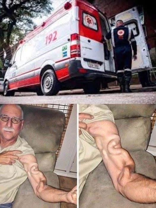 A man goes to stretch and ends up feeling a sharp pain in his arm, it was a ca… See More👇 See less