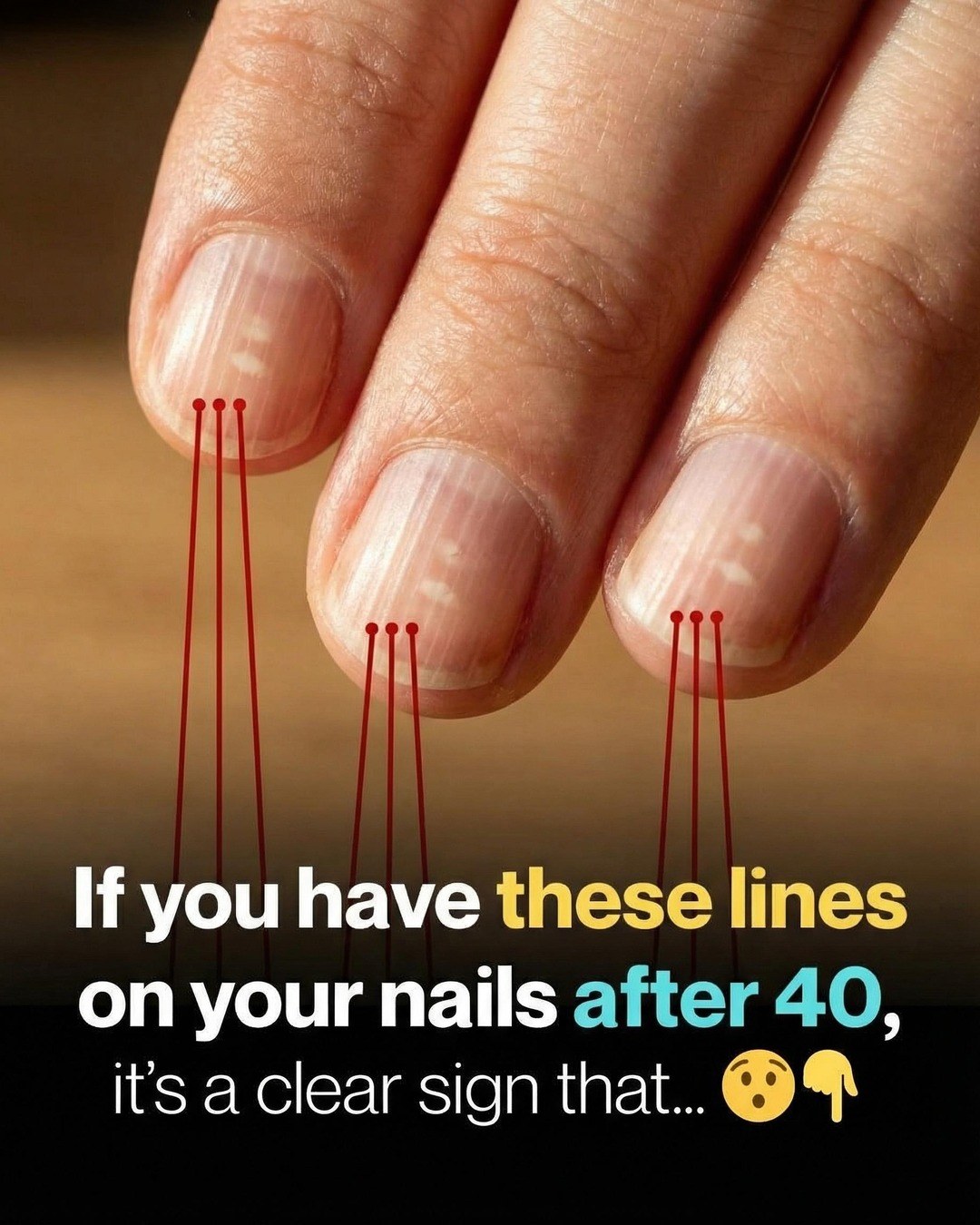 If you have these vertical lines on your nails after 40, it’s a clear sign of… see more 👀👇