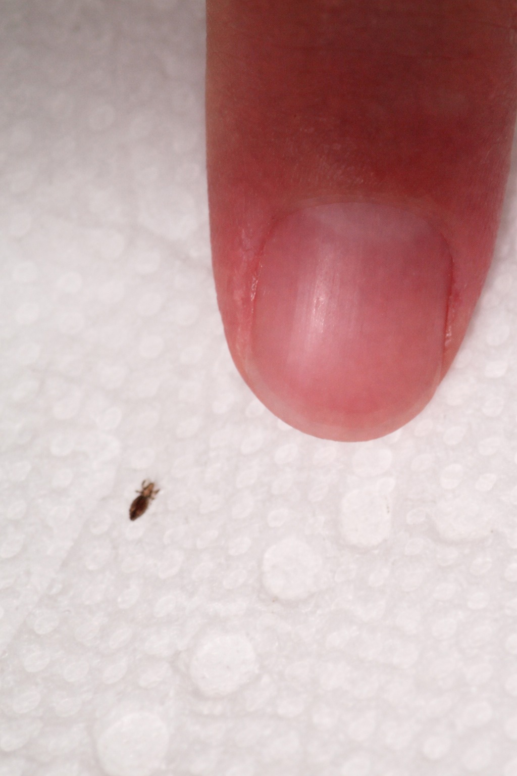 ”Wife found this in our toddler’s hair. Anything we should worry about? He goes to daycare 3 times a week.😳 check the first comment👇