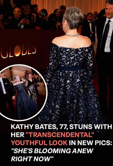 Kathy Bates is turning heads—she looks even better than she did 20 years ago!  See the new, much-talked-about pictures. (Check In First comment👇)