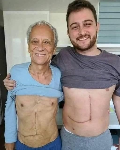 A son donated part of his liver to save his father’s life — but what happened to him afterward left doctors and family completely shattered… See more 😢⬇️