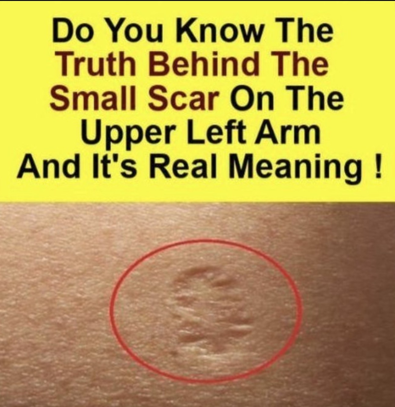 Wait… I’ve seen this somewhere before! 😲😲(Check In First comment👇)